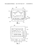 WIRELESS DATA COMMUNICATION PROTOCOLS FOR A MEDICAL DEVICE NETWORK diagram and image