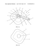 REDUCED PRESSURE THERAPY DEVICES diagram and image