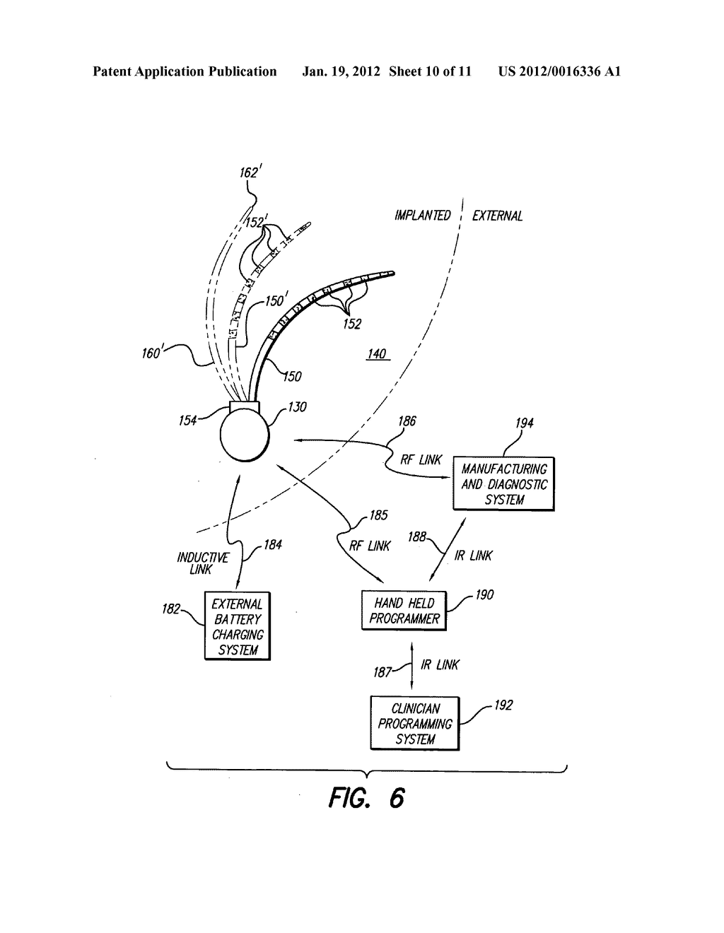 TREATMENT OF MOOD AND/OR ANXIETY DISORDERS BY ELECTRICAL BRAIN STIMULATION     AND/OR DRUG INFUSION - diagram, schematic, and image 11