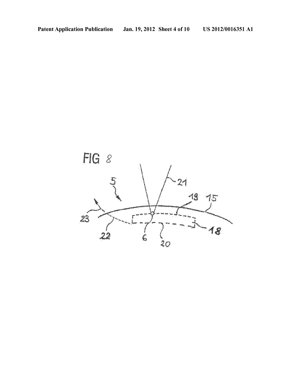 DEVICE AND METHOD FOR PRODUCING CONTROL DATA FOR THE SURGICAL CORRECTION     OF DEFECTIVE EYE VISION - diagram, schematic, and image 05