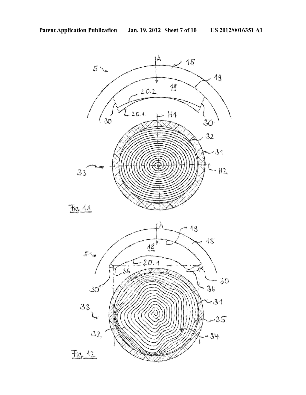 DEVICE AND METHOD FOR PRODUCING CONTROL DATA FOR THE SURGICAL CORRECTION     OF DEFECTIVE EYE VISION - diagram, schematic, and image 08