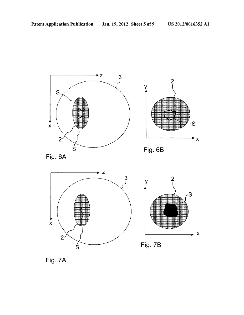 OPHTHALMOLOGIC LASER SYSTEM - diagram, schematic, and image 06