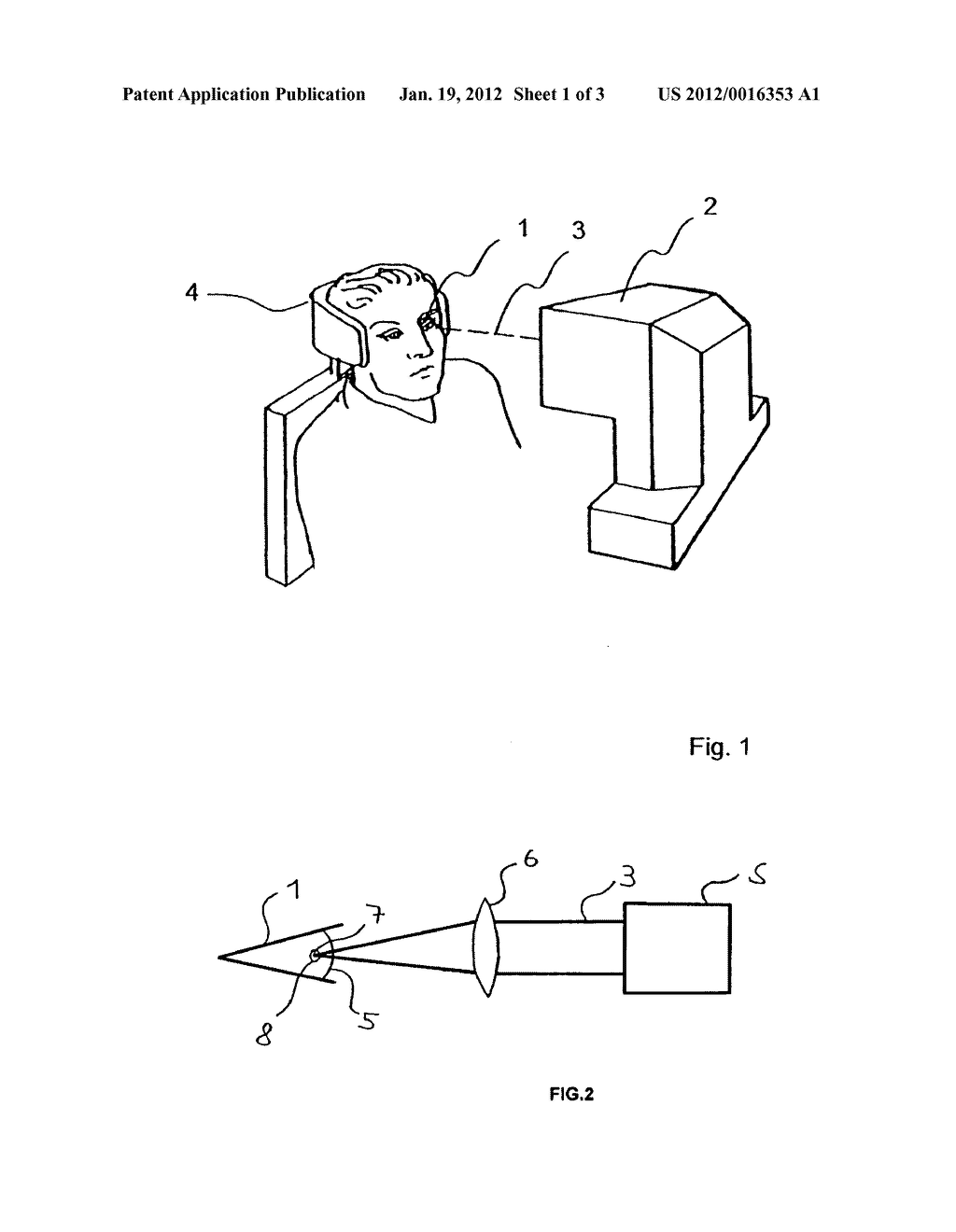 APPARATUS AND METHOD FOR REMOVING A LENTICLE FROM THE CORNEA - diagram, schematic, and image 02