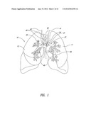 SYSTEMS, ASSEMBLIES, AND METHODS FOR TREATING A BRONCHIAL TREE diagram and image