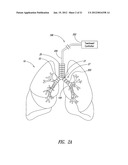 SYSTEMS, ASSEMBLIES, AND METHODS FOR TREATING A BRONCHIAL TREE diagram and image