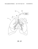 SYSTEMS, ASSEMBLIES, AND METHODS FOR TREATING A BRONCHIAL TREE diagram and image