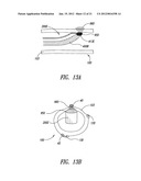 SYSTEMS, ASSEMBLIES, AND METHODS FOR TREATING A BRONCHIAL TREE diagram and image