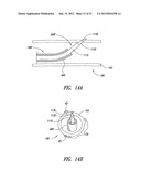 SYSTEMS, ASSEMBLIES, AND METHODS FOR TREATING A BRONCHIAL TREE diagram and image