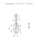 SYSTEMS, ASSEMBLIES, AND METHODS FOR TREATING A BRONCHIAL TREE diagram and image