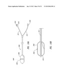 SYSTEMS, ASSEMBLIES, AND METHODS FOR TREATING A BRONCHIAL TREE diagram and image