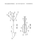 SYSTEMS, ASSEMBLIES, AND METHODS FOR TREATING A BRONCHIAL TREE diagram and image