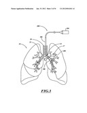 DELIVERY DEVICES WITH COOLABLE ENERGY EMITTING ASSEMBLIES diagram and image