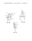 Facet Joint Replacement Instruments and Methods diagram and image