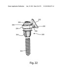 Facet Joint Replacement Instruments and Methods diagram and image