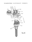 Facet Joint Replacement Instruments and Methods diagram and image