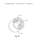 Facet Joint Replacement Instruments and Methods diagram and image