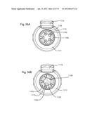 Facet Joint Replacement Instruments and Methods diagram and image