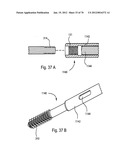 Facet Joint Replacement Instruments and Methods diagram and image