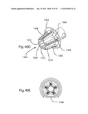 Facet Joint Replacement Instruments and Methods diagram and image