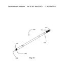 Facet Joint Replacement Instruments and Methods diagram and image