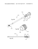 Facet Joint Replacement Instruments and Methods diagram and image