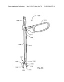 Facet Joint Replacement Instruments and Methods diagram and image