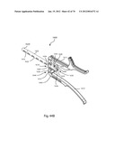 Facet Joint Replacement Instruments and Methods diagram and image