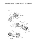 Facet Joint Replacement Instruments and Methods diagram and image