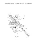 Facet Joint Replacement Instruments and Methods diagram and image