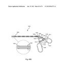 Facet Joint Replacement Instruments and Methods diagram and image