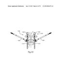 Facet Joint Replacement Instruments and Methods diagram and image