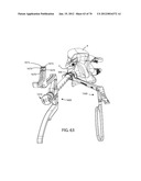 Facet Joint Replacement Instruments and Methods diagram and image