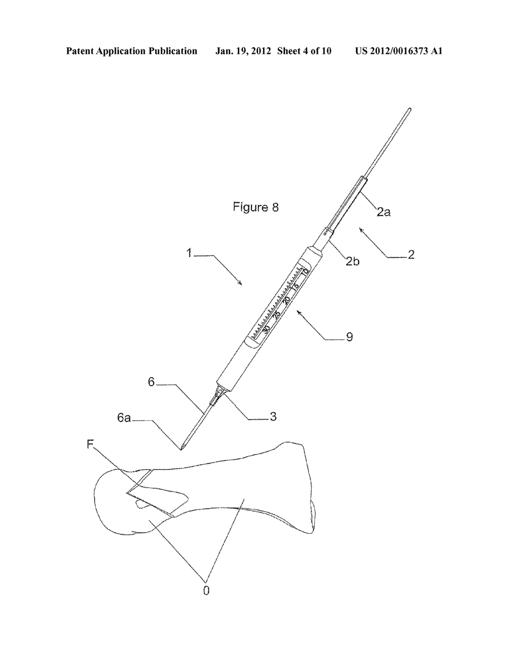 DEVICE TO ASSIST WITH THE PLACEMENT OF SCREWS IN BONE TISSUE AND     INSTRUMENT APPLYING SAID DEVICE, IN PARTICULAR FOR PERFORMING     OSTEOSYNTHESIS OF BONE FRAGMENTS - diagram, schematic, and image 05