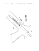 VALVE LOADER METHOD, SYSTEM, AND APPARATUS diagram and image