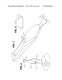 SKIN ABRASION SYSTEM AND METHOD diagram and image