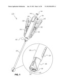 METHOD FOR SUTURING diagram and image