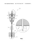 METHOD FOR SUTURING diagram and image