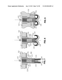 METHOD FOR SUTURING diagram and image