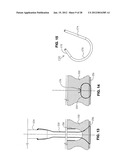 METHOD FOR SUTURING diagram and image