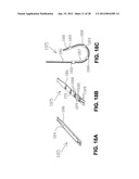 METHOD FOR SUTURING diagram and image