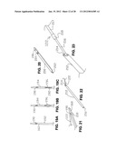 METHOD FOR SUTURING diagram and image