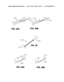 METHOD FOR SUTURING diagram and image