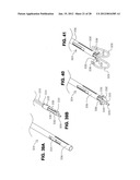 METHOD FOR SUTURING diagram and image