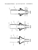 METHOD FOR SUTURING diagram and image