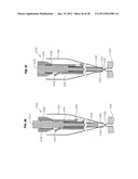 METHOD FOR SUTURING diagram and image