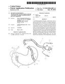 Method of Performing Transgastric Ventral Hernia Repair and Tissue Anchors     and Deployment Devices Therefor diagram and image