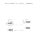 Method of Performing Transgastric Ventral Hernia Repair and Tissue Anchors     and Deployment Devices Therefor diagram and image