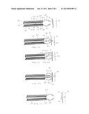 Method of Performing Transgastric Ventral Hernia Repair and Tissue Anchors     and Deployment Devices Therefor diagram and image