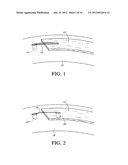 SYSTEM AND METHOD FOR ATTACHING SOFT TISSUE TO BONE diagram and image