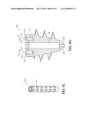 SYSTEM AND METHOD FOR ATTACHING SOFT TISSUE TO BONE diagram and image